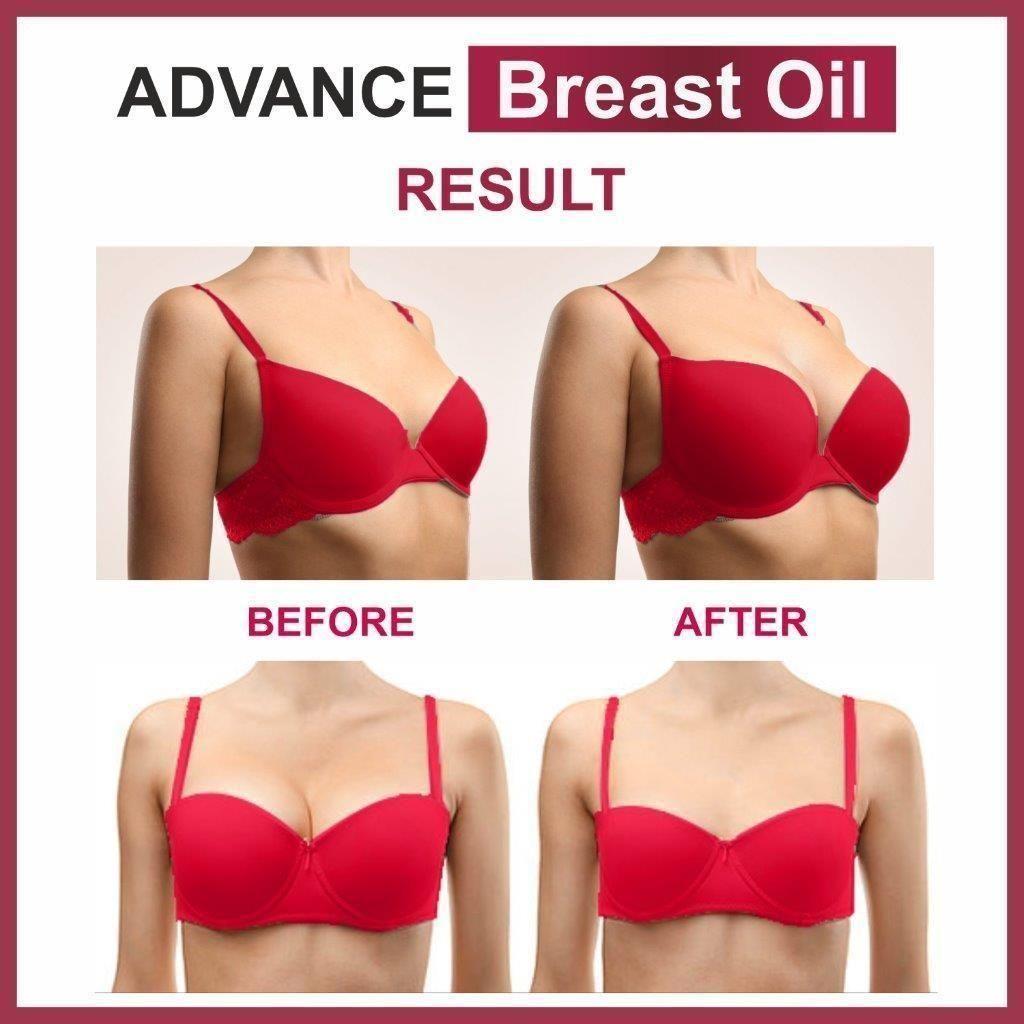 Advance Breast Oil (Pack of 2)