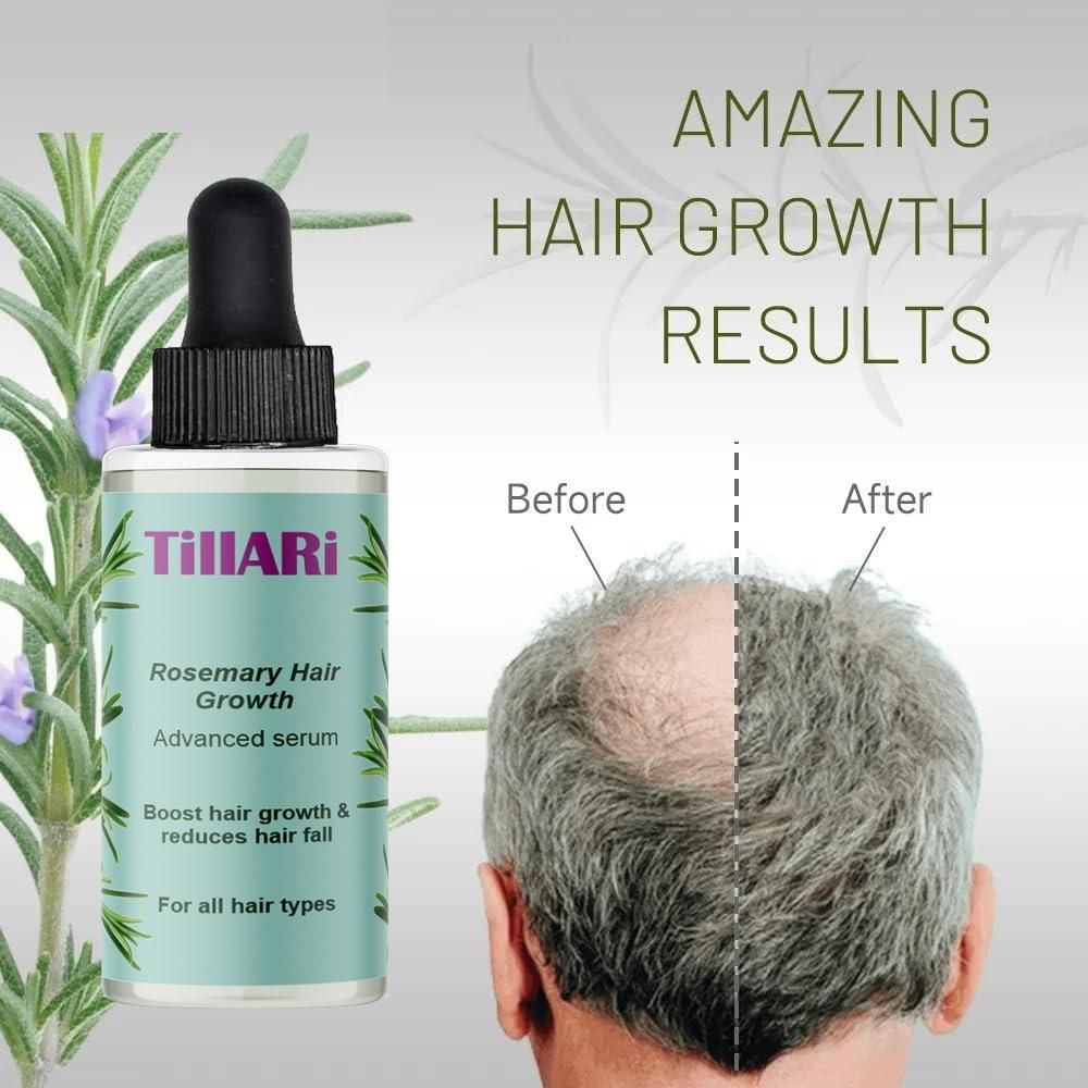 Tillari Rosemary Hair Growth Serum (Pack of 2)