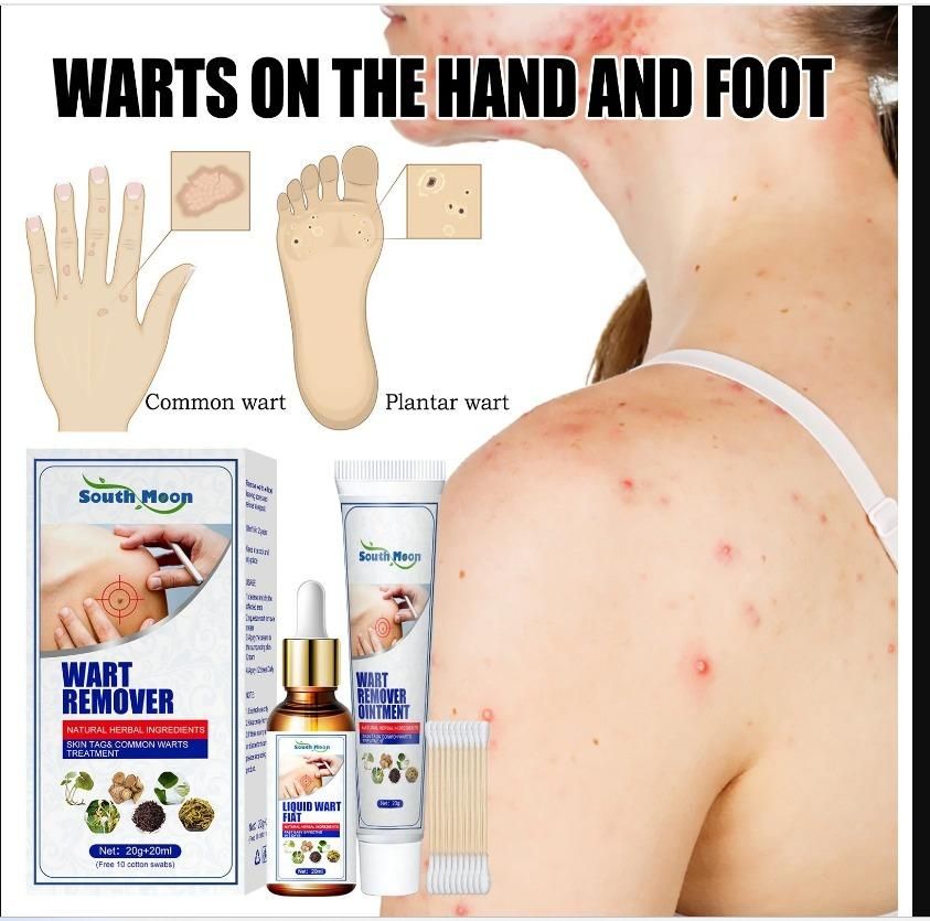 Herbal Wart Removal Cream